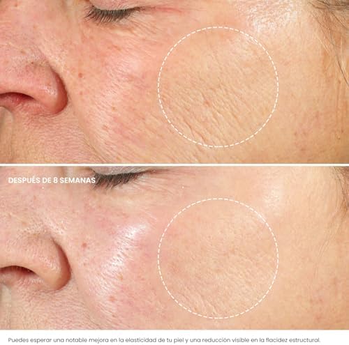  hidratante facial mujer y hombres retinol ácido hialurónico vitamina e - crema antiarrugas reducir arrugas líneas finas